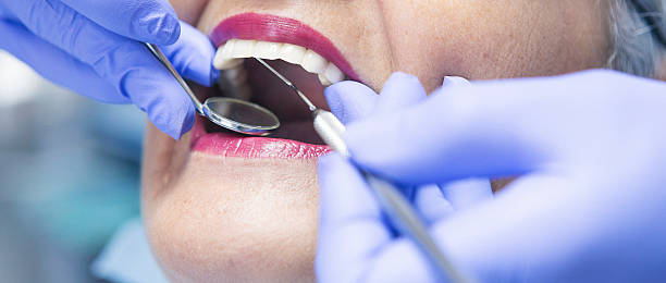 Best Emergency Dentist for Knocked-Out Tooth in Centereach, NY